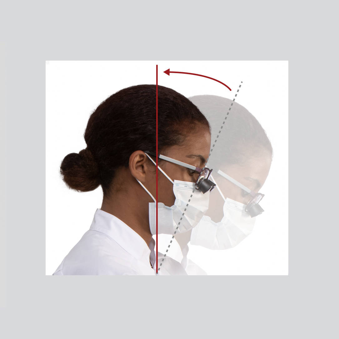 Prisma Lens System for extra declination