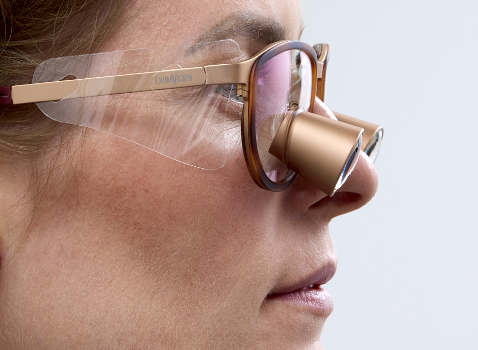 2025 07 Sideshields Acc